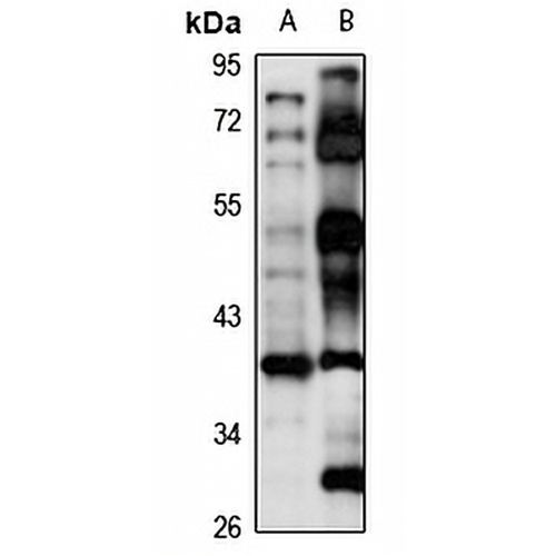 SPRY2 Rabbit Polyclonal Antibody