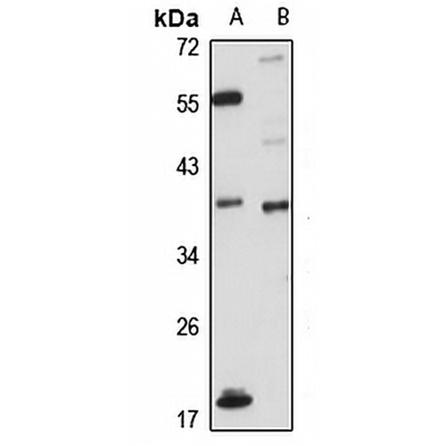 SPRY4 Rabbit Polyclonal Antibody