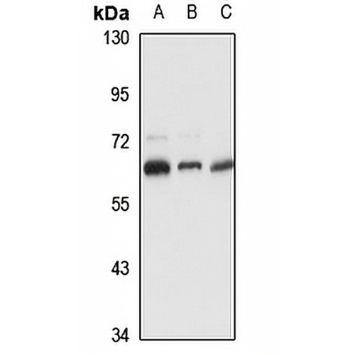 SREBP2 Rabbit Polyclonal Antibody