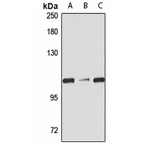 SRRM1 Rabbit Polyclonal Antibody