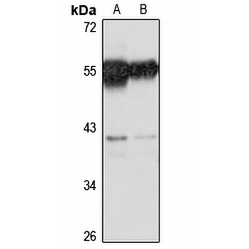 SRSF6 Rabbit Polyclonal Antibody