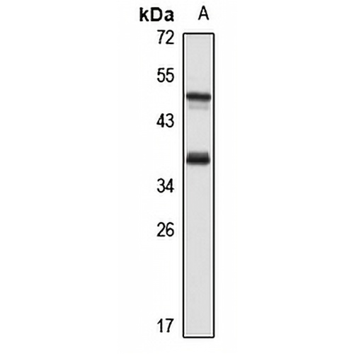 TRAP-alpha Rabbit Polyclonal Antibody
