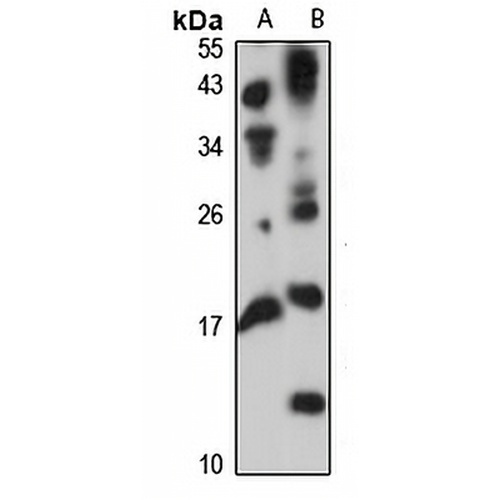 TRAP-delta Rabbit Polyclonal Antibody