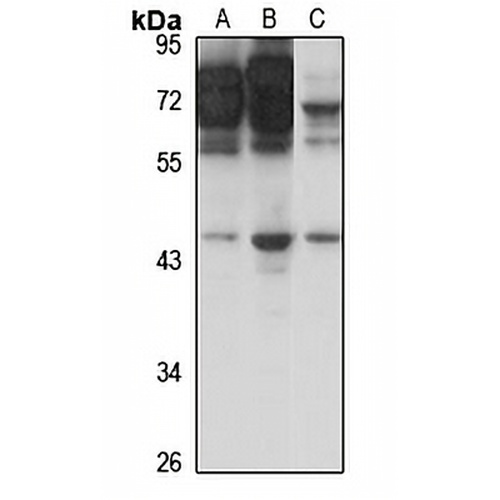 SSTR3 Rabbit Polyclonal Antibody