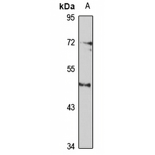 SSTR5 Rabbit Polyclonal Antibody