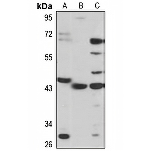 ST3GAL2 Rabbit Polyclonal Antibody