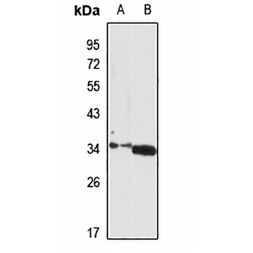 Sialyltransferase 7D Rabbit Polyclonal Antibody