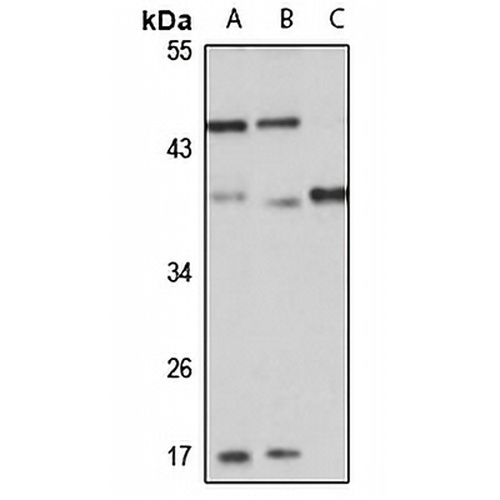Sialyltransferase 7E Rabbit Polyclonal Antibody