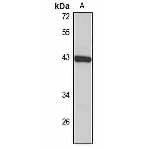 ST8SIA1 Rabbit Polyclonal Antibody