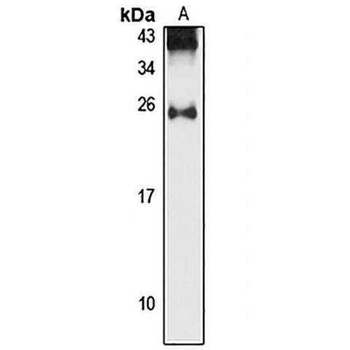 StARD5 Rabbit Polyclonal Antibody