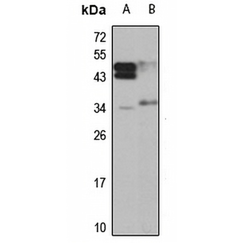 STK16 Rabbit Polyclonal Antibody