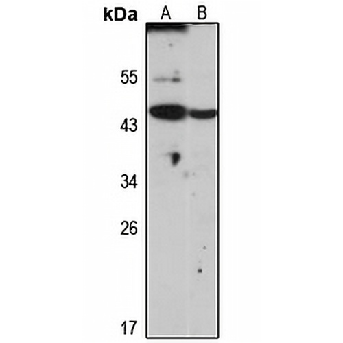 Syntaxin-18 Rabbit Polyclonal Antibody