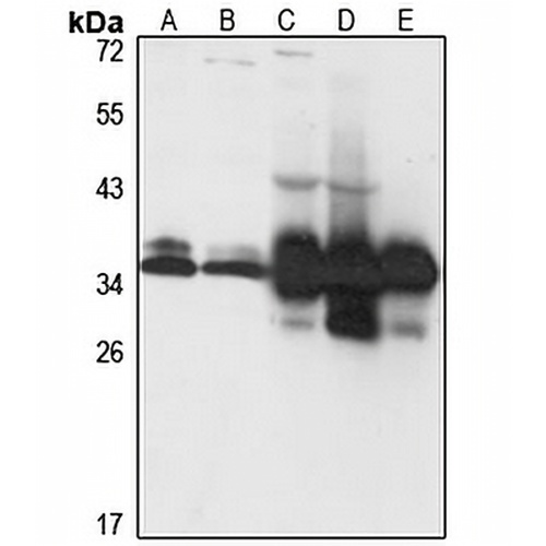 SUCLG1 Rabbit Polyclonal Antibody