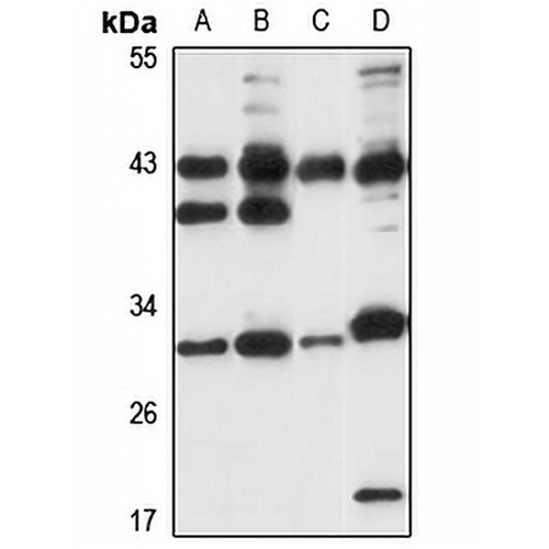 SUGT1 Rabbit Polyclonal Antibody