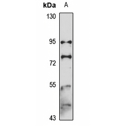SUN1 Rabbit Polyclonal Antibody