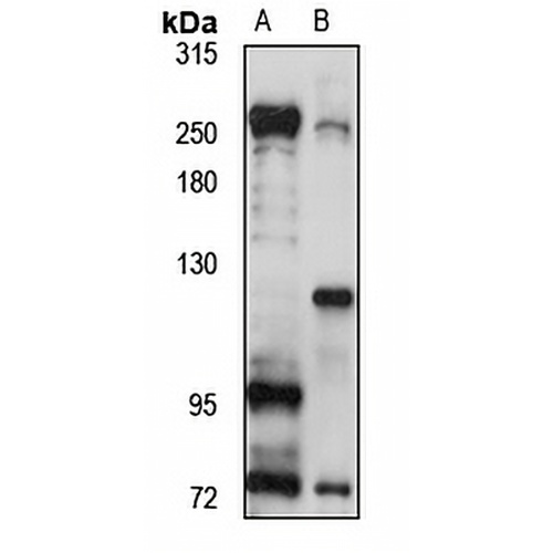 SPT6 Rabbit Polyclonal Antibody