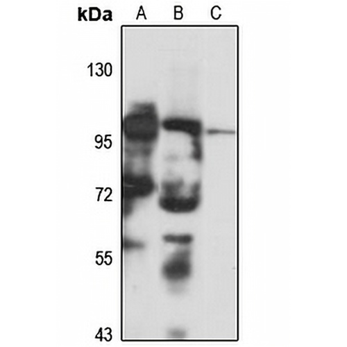 SUV420H1 Rabbit Polyclonal Antibody