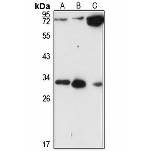 CCDC44 Rabbit Polyclonal Antibody