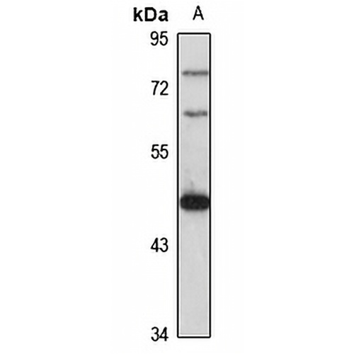 Tachykinin Receptor 2 Rabbit Polyclonal Antibody