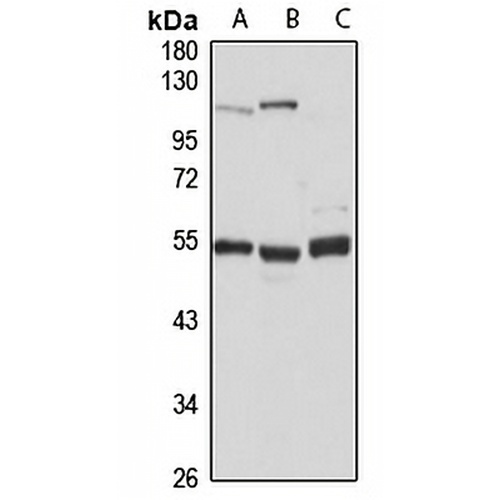 TADA3L Rabbit Polyclonal Antibody