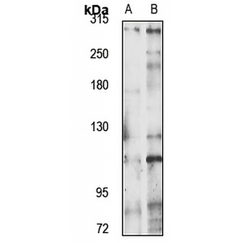 TAF1 Rabbit Polyclonal Antibody