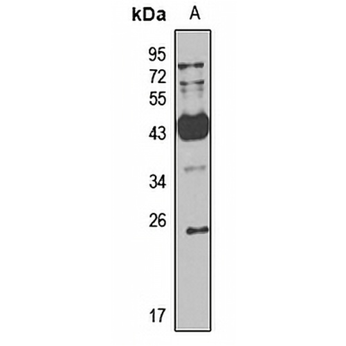 TAF11 Rabbit Polyclonal Antibody