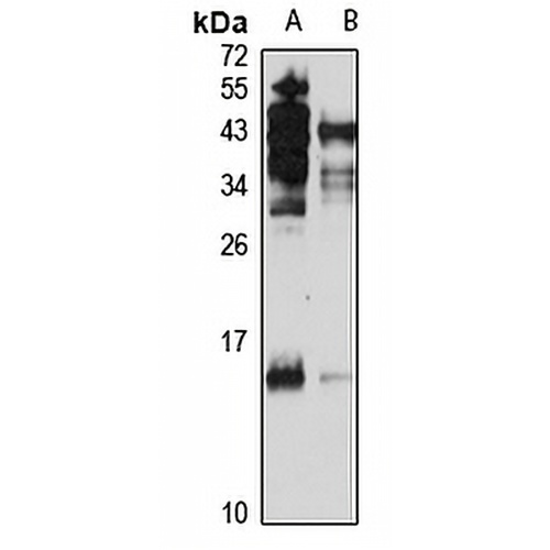 TAF12 Rabbit Polyclonal Antibody