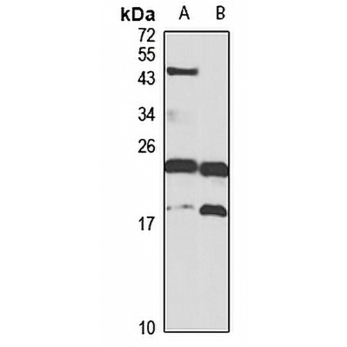 TAF9 Rabbit Polyclonal Antibody