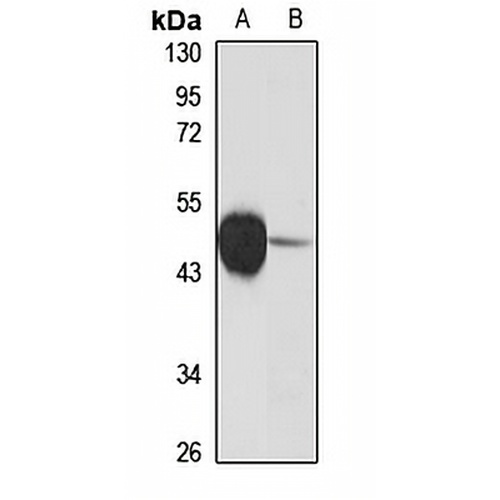 TAL1 Rabbit Polyclonal Antibody