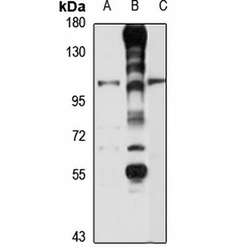 GPR70 Rabbit Polyclonal Antibody