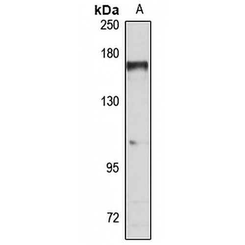 TBC1D1 Rabbit Polyclonal Antibody