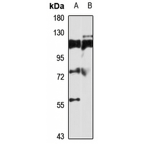 TBC1D15 Rabbit Polyclonal Antibody