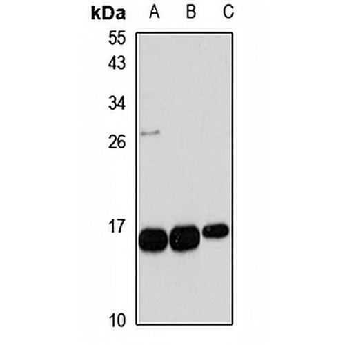 TBCA Rabbit Polyclonal Antibody