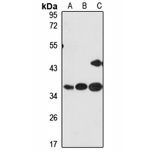 CKAP1 Rabbit Polyclonal Antibody