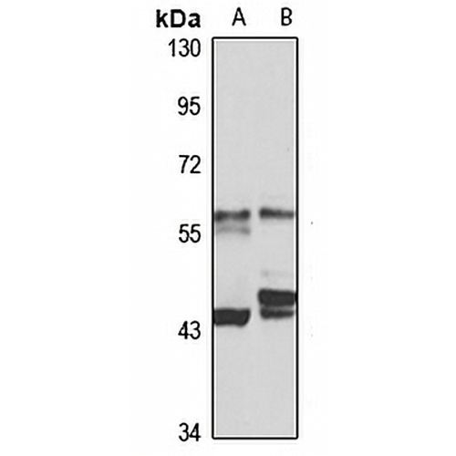 TBCE Rabbit Polyclonal Antibody