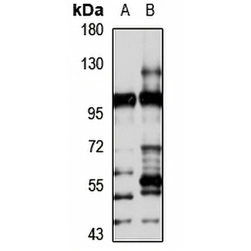 TBL3 Rabbit Polyclonal Antibody