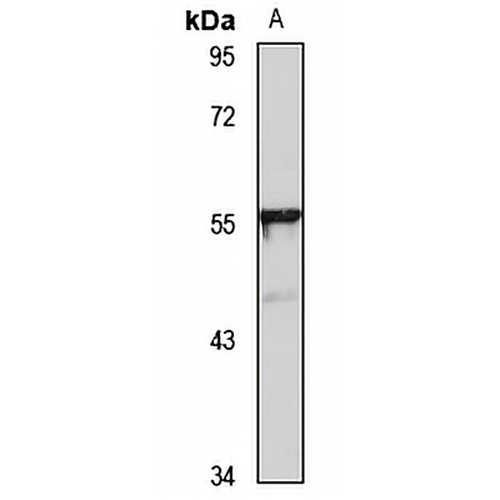 TBX20 Rabbit Polyclonal Antibody