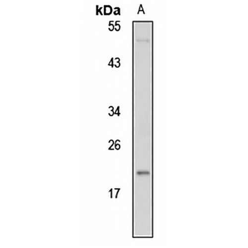 POD-1 Rabbit Polyclonal Antibody