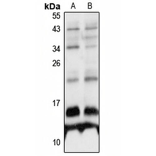TCTA Rabbit Polyclonal Antibody
