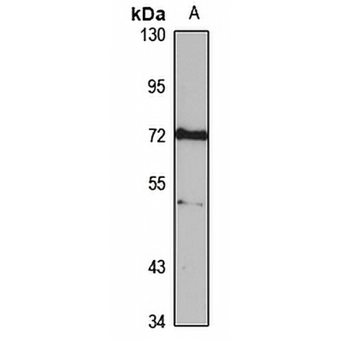 TDRD3 Rabbit Polyclonal Antibody