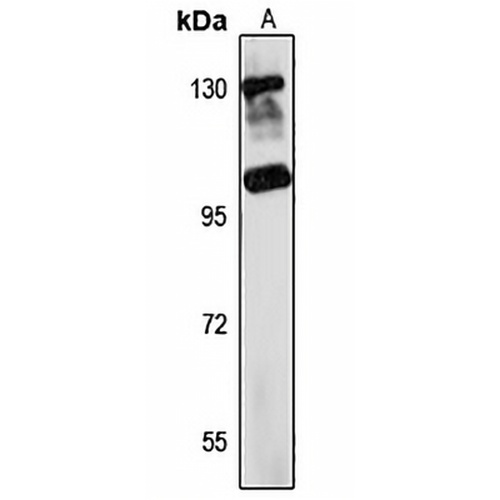 TEX2 Rabbit Polyclonal Antibody