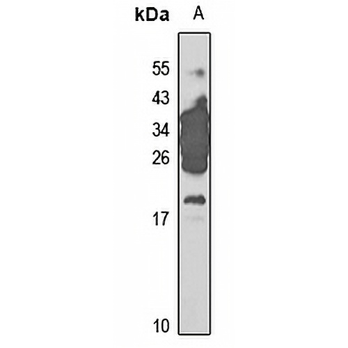 Trefoil Factor 3 Rabbit Polyclonal Antibody