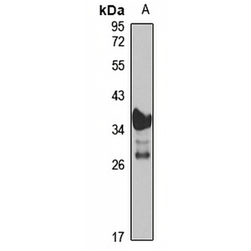 Transglutaminase 4 Rabbit Polyclonal Antibody