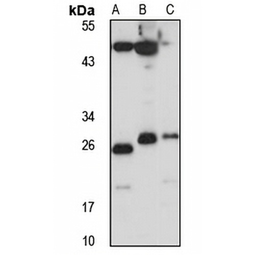 CTMP Rabbit Polyclonal Antibody