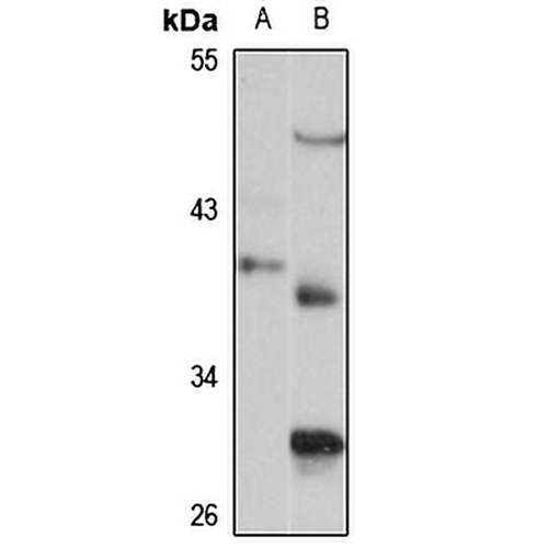 THOC3 Rabbit Polyclonal Antibody