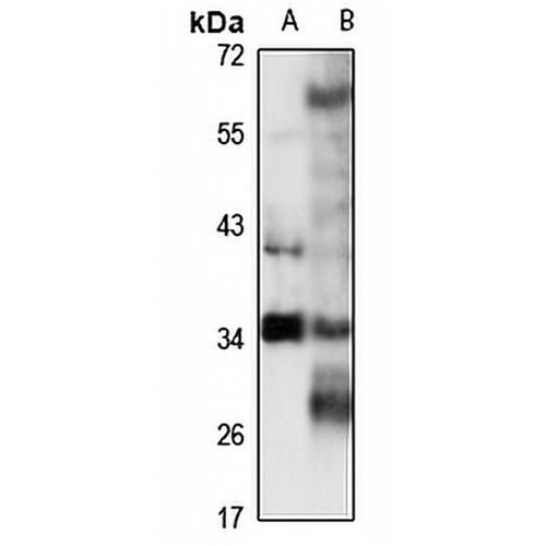THOC6 Rabbit Polyclonal Antibody