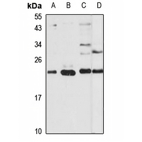 THOC7 Rabbit Polyclonal Antibody