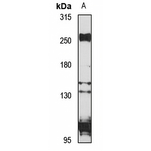 THSD7A Rabbit Polyclonal Antibody