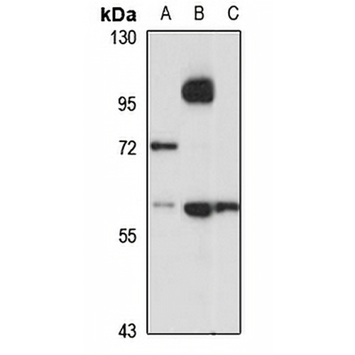 THUMPD2 Rabbit Polyclonal Antibody