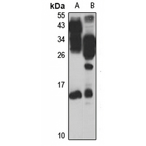 TIAF1 Rabbit Polyclonal Antibody